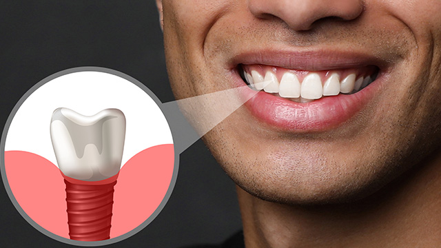 Image of a man smiling with an illustration of a toothbrush and toothpaste overlay.
